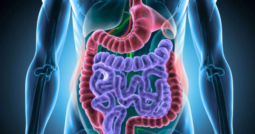 Alleviating irritable bowel syndrome